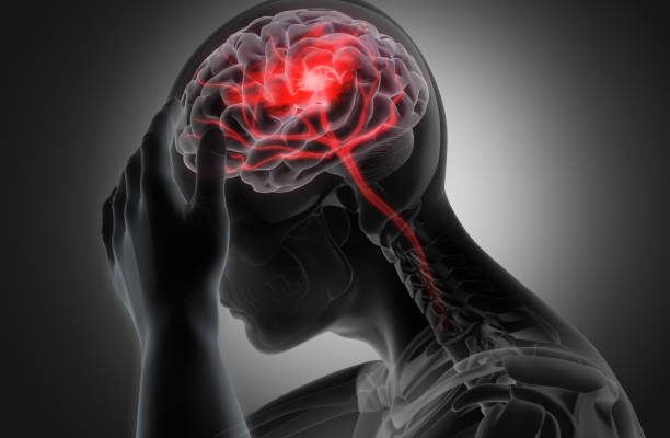 Traumatic Brain Injury (TBI)