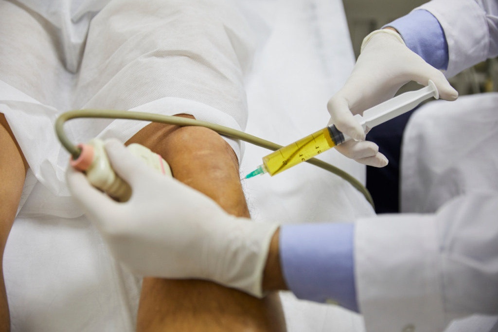 Avoid Surgery! Try Stem Cell for Knee Repair