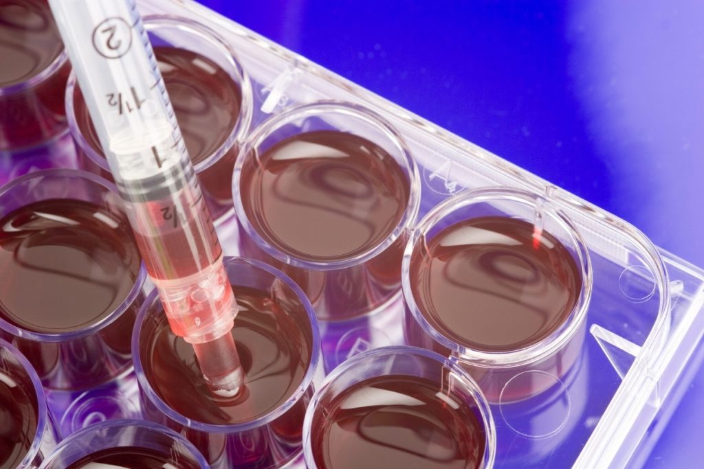 6 Tips for Maximizing the Benefits of Stem Cell Therapy Near Me for Degenerative Arthritis