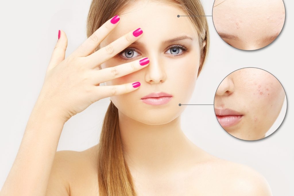 4. Clears and Unclogs Skin Pores
