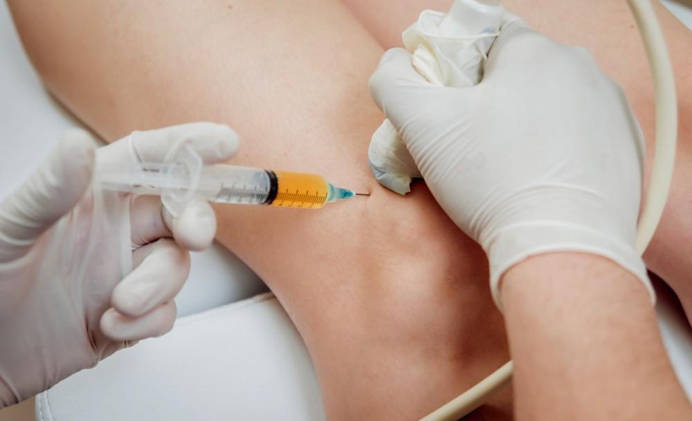 Exosome Therapy Over Traditional Therapies