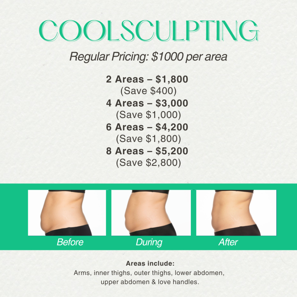 CoolSculpting