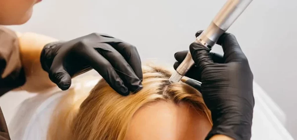 Microneedling Session