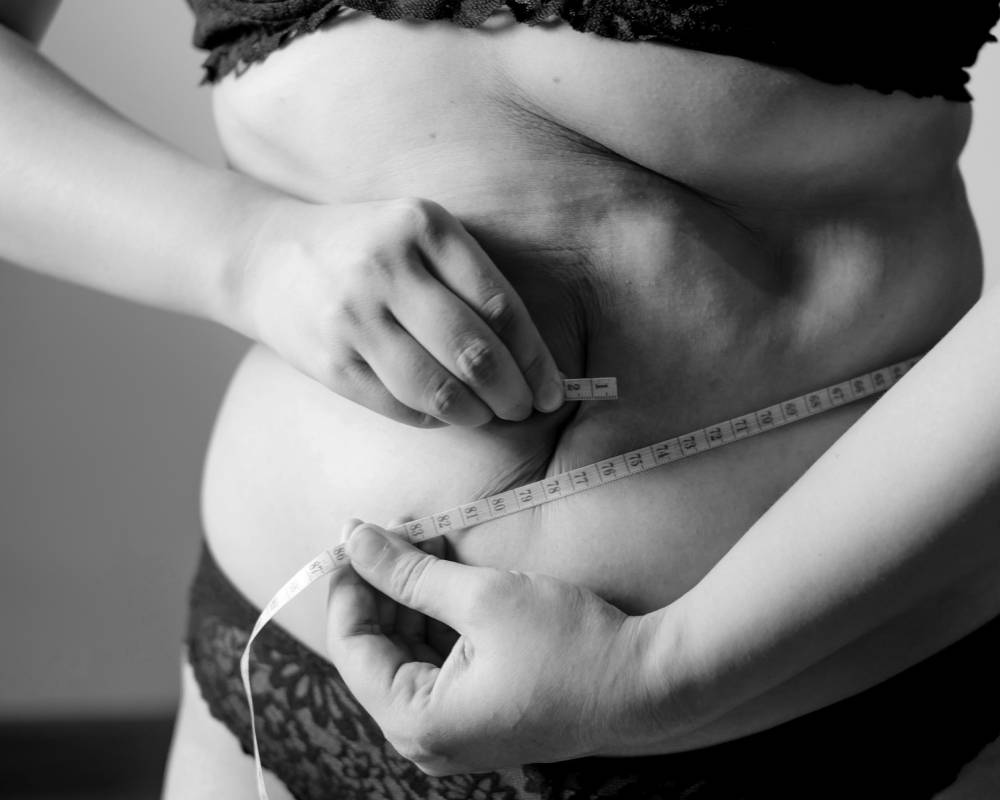 Body Sculpt Treatment Is Ideal After Weight Loss