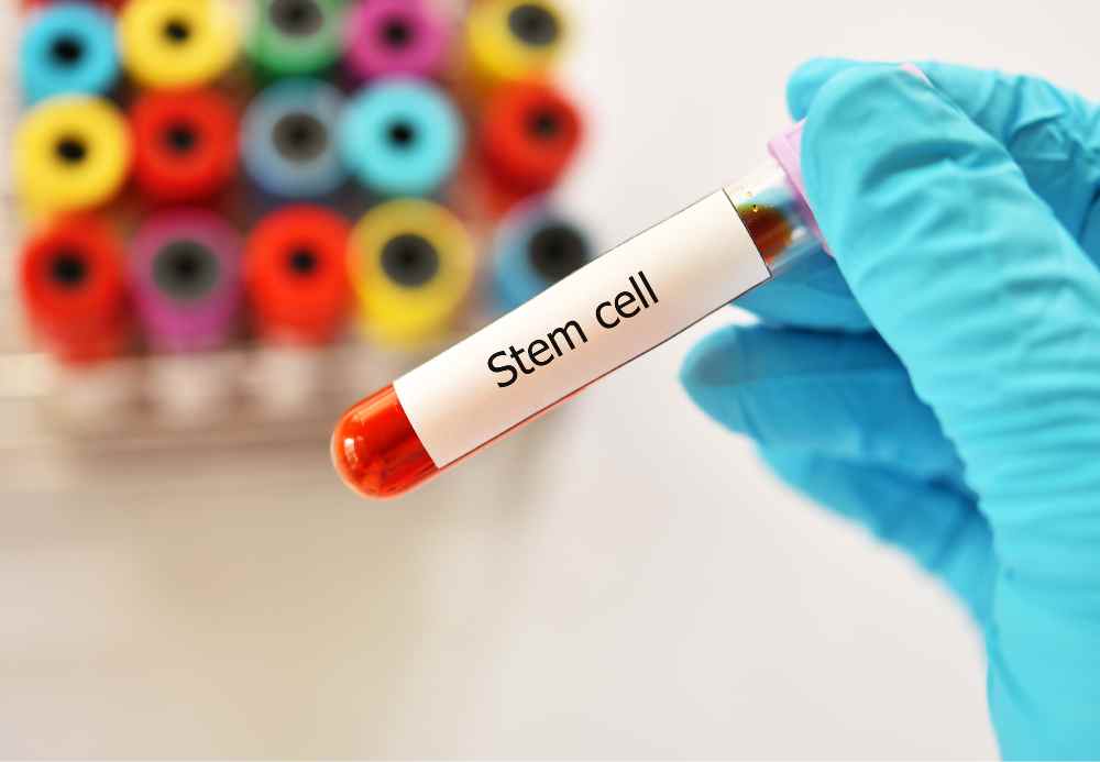 Stem-Cell-2.jpg