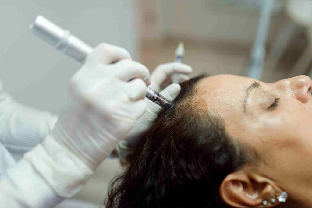 Microneedling