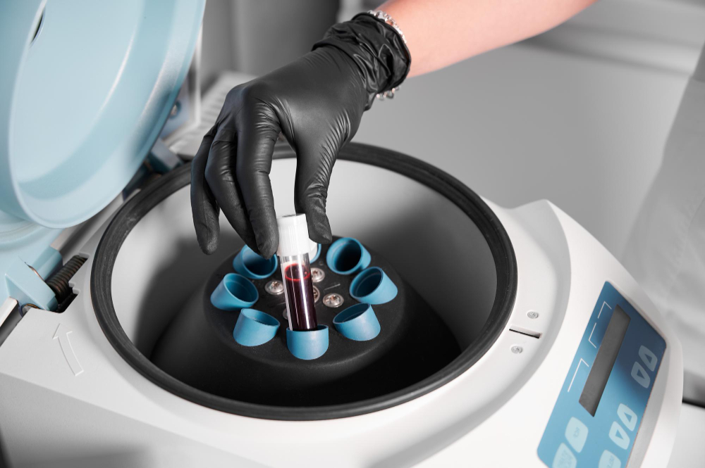Stem cell therapy
