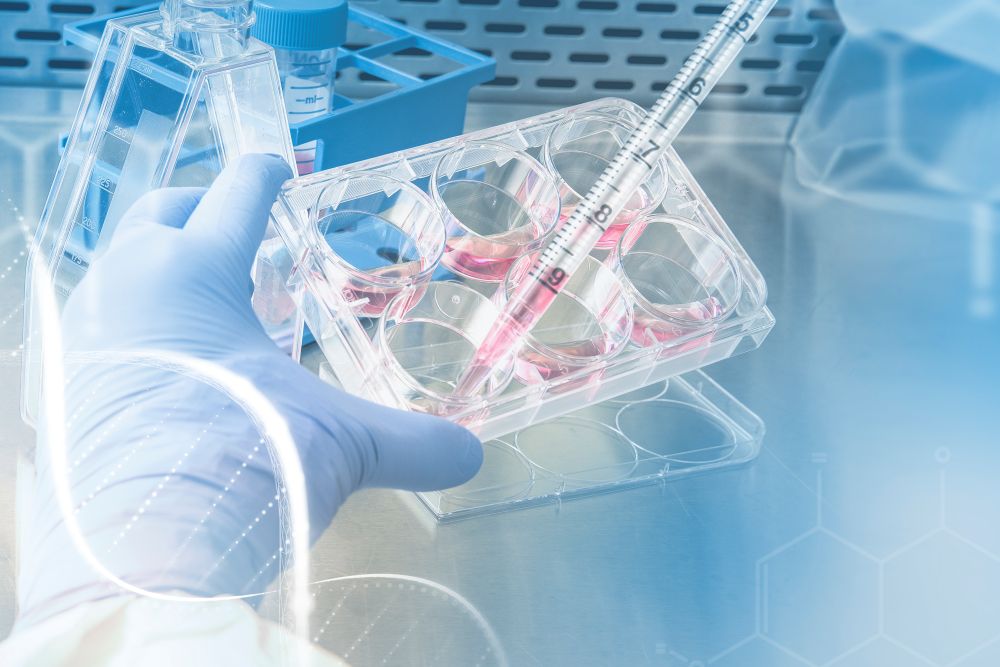 Exosomes therapy
